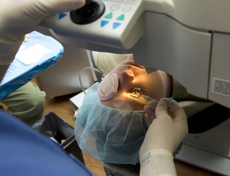 Equipamentos oftalmológicos de alta tecnologia para cirurgia refrativa e catarata na Phocus